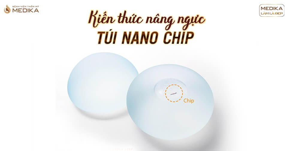 Túi Nano Chip lựa chọn Chuẩn không cần chỉnh - Kiến thức nâng ngực